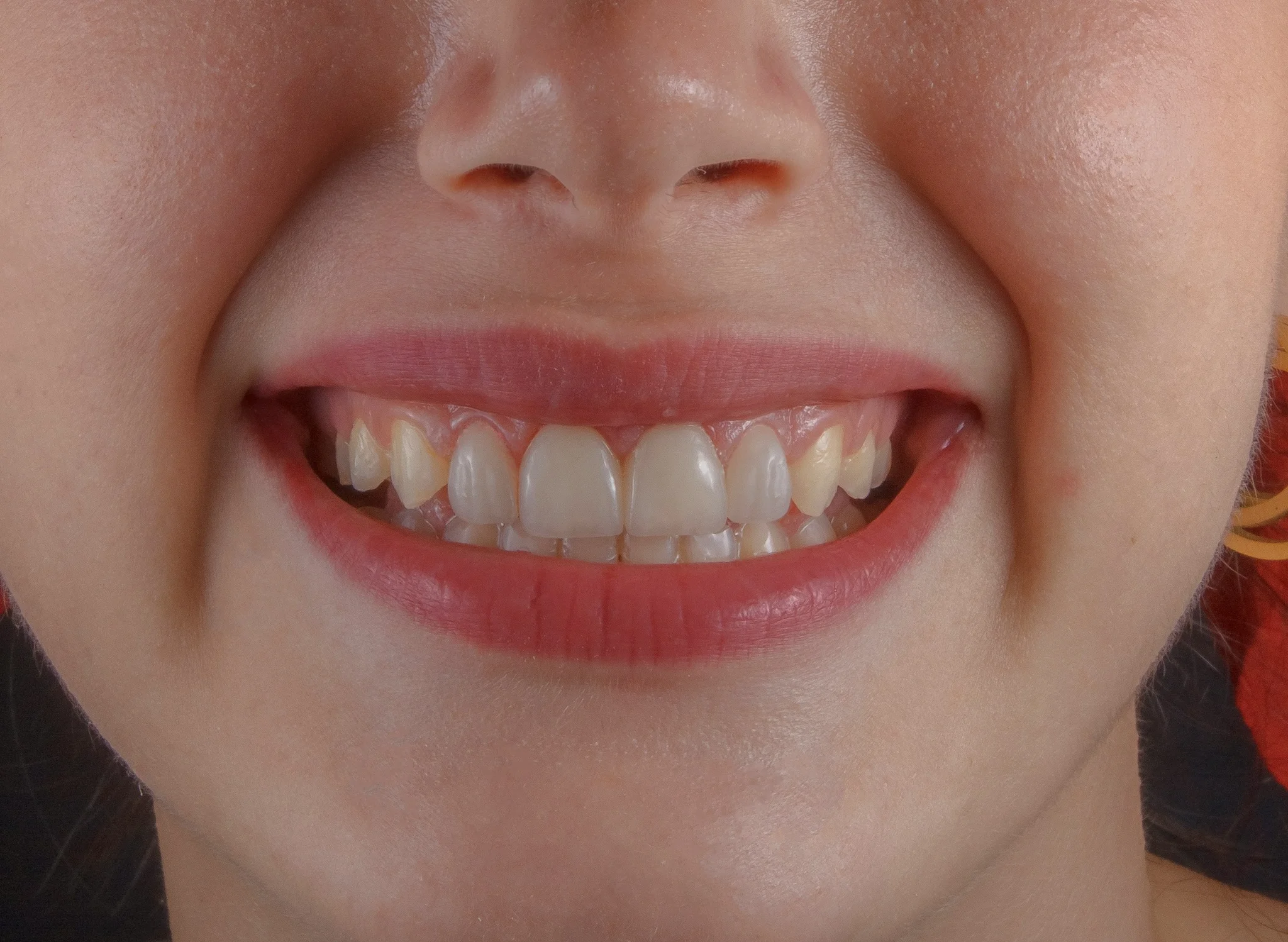 Sonrisa perfecta - AP Dental